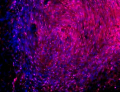 Neural stem cells pre-treated with metformin integrate into the brain and give rise to new neurons.